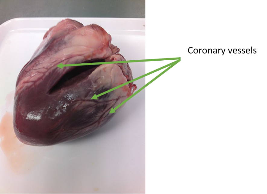 picture of heart with arrows point to coronary vessels